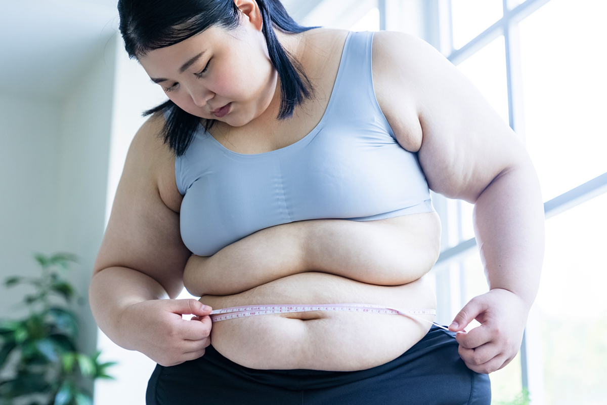 縮胃手術會復胖嗎？7種減重代謝手術、費用、適應症