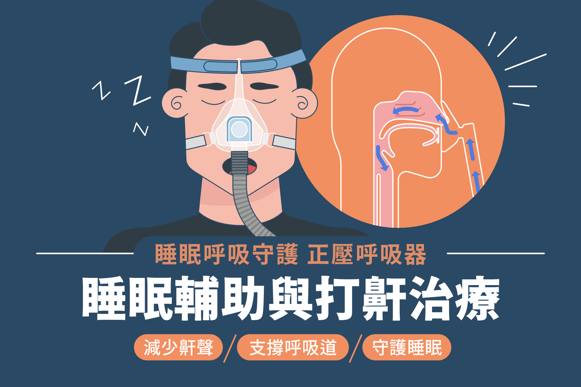 打呼就是睡眠呼吸中止症嗎？檢測方法、治療方案與正壓呼吸器的幫助