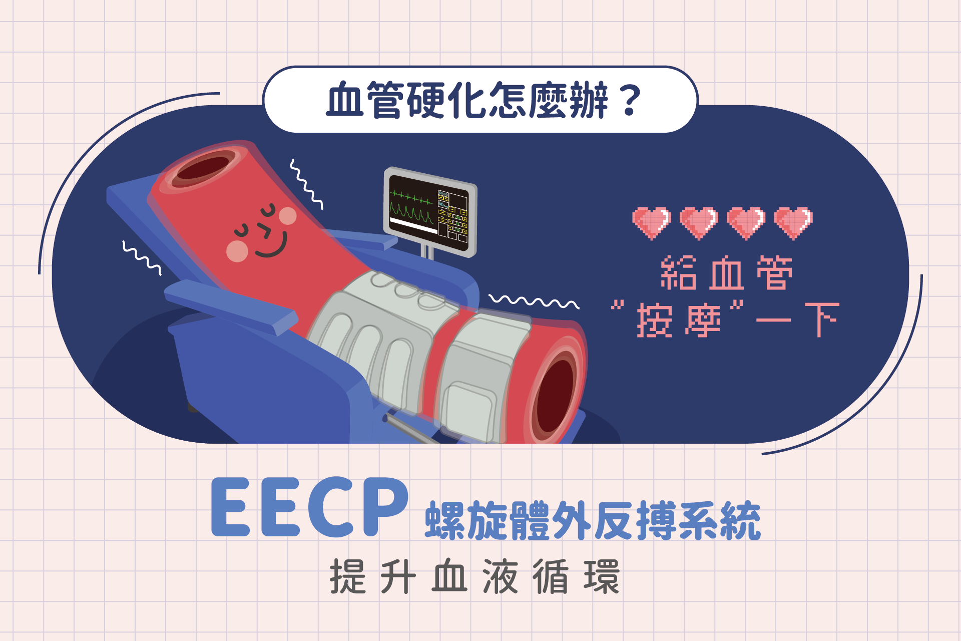 血管硬化怎麼辦？新世代體外反搏系統EECP提升血液循環