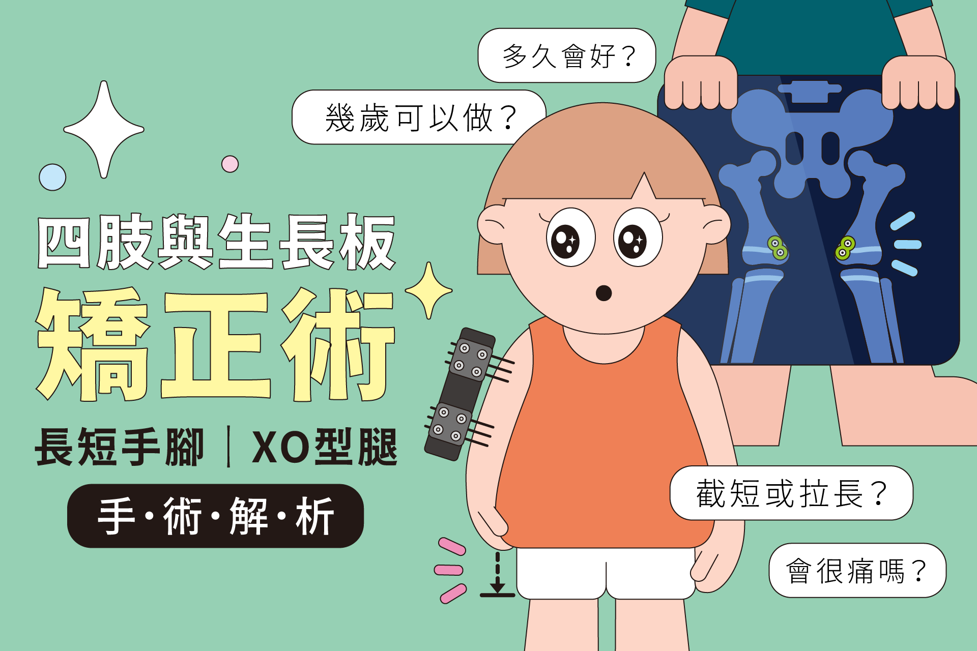 兒童O型腿、X型腿、長短腳如何矯正？原因、矯正方法與手術治療