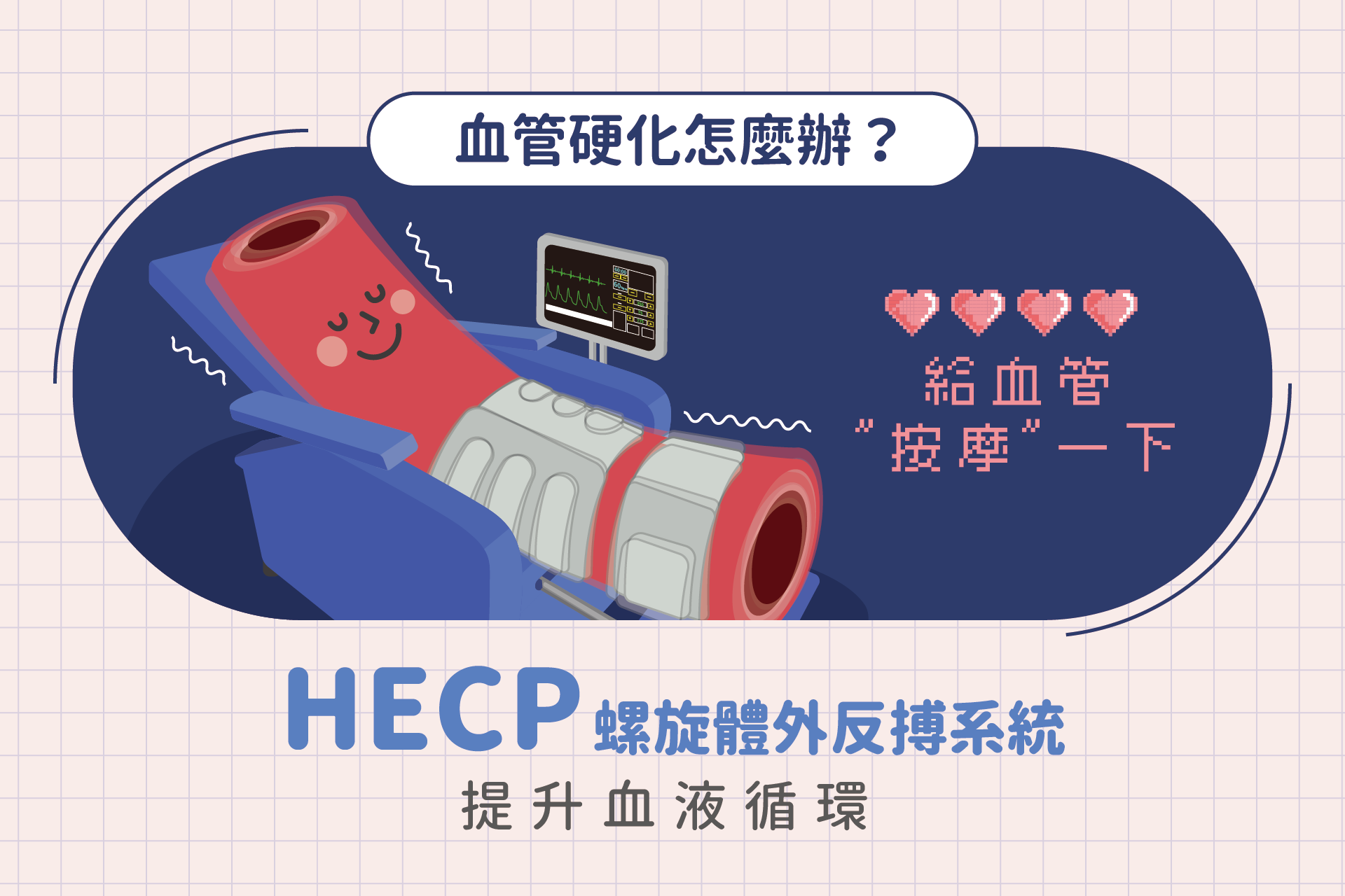 血管硬化怎麼辦？新世代體外反搏系統HECP提升血液循環
