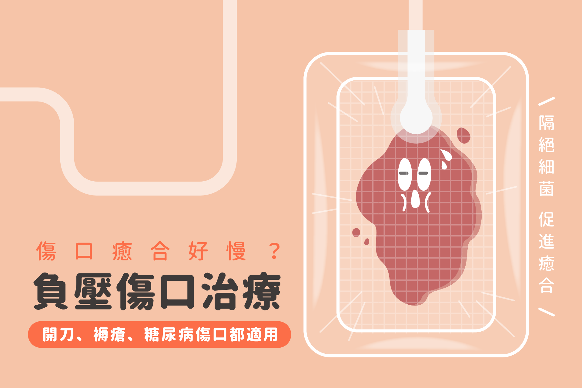傷口癒合好慢？負壓傷口治療加速傷口癒合，開刀、褥瘡、糖尿病傷口都適用