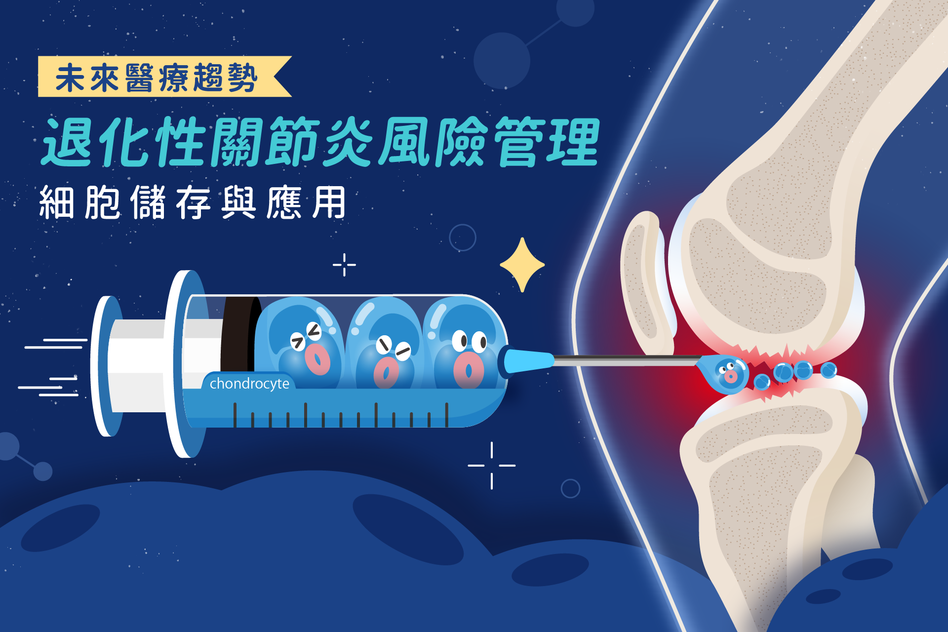 退化性關節炎的治療趨勢與風險管理：原因、症狀與細胞儲存