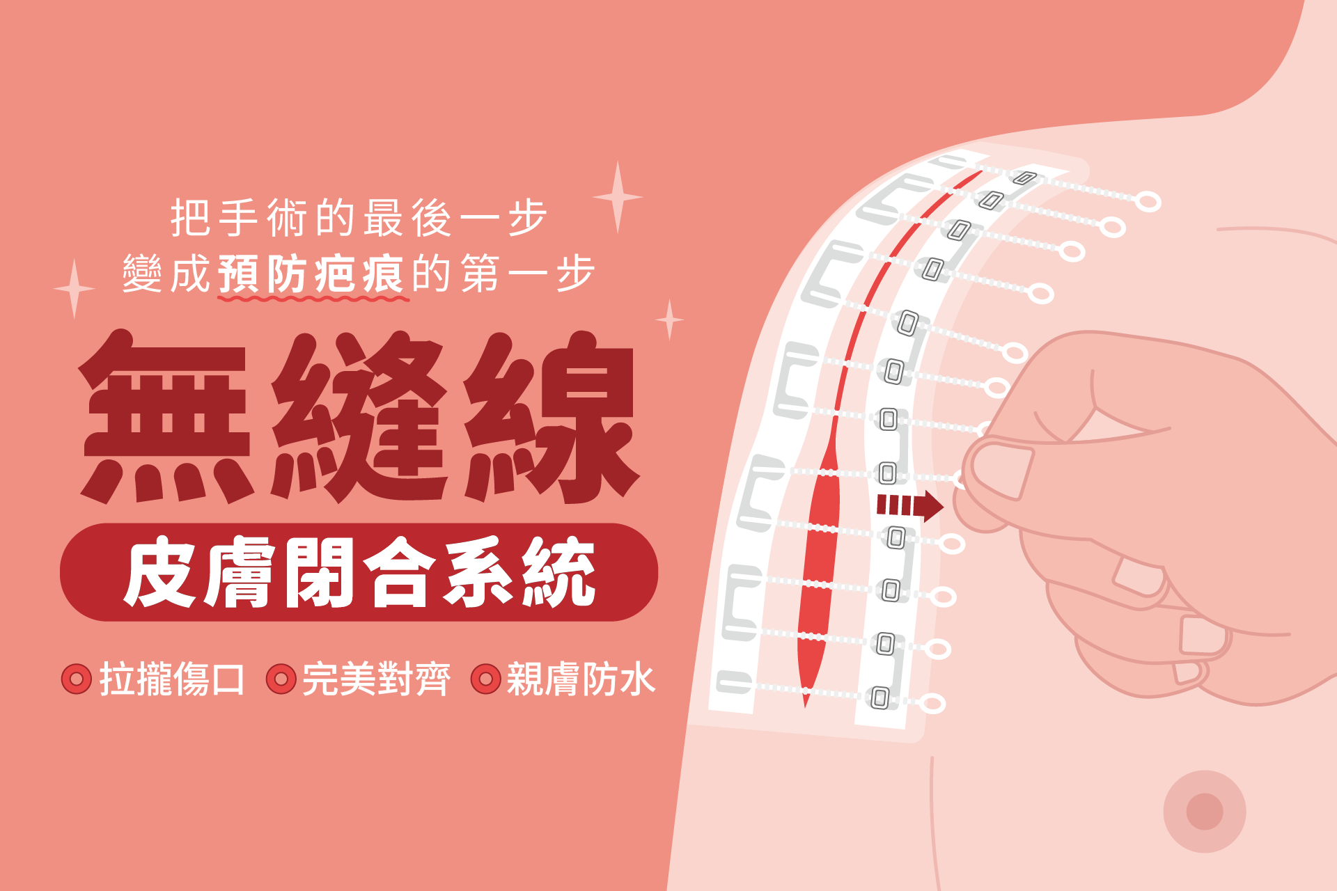 傷口縫合方式決定疤痕外觀？新型無縫線皮膚閉合系統，助力傷口癒合、減少疤痕形成
