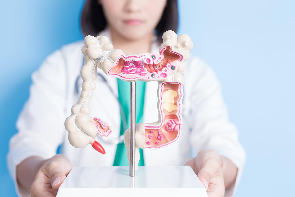 大腸癌的原因是什麼？了解大腸癌的症狀、成因、治療方式