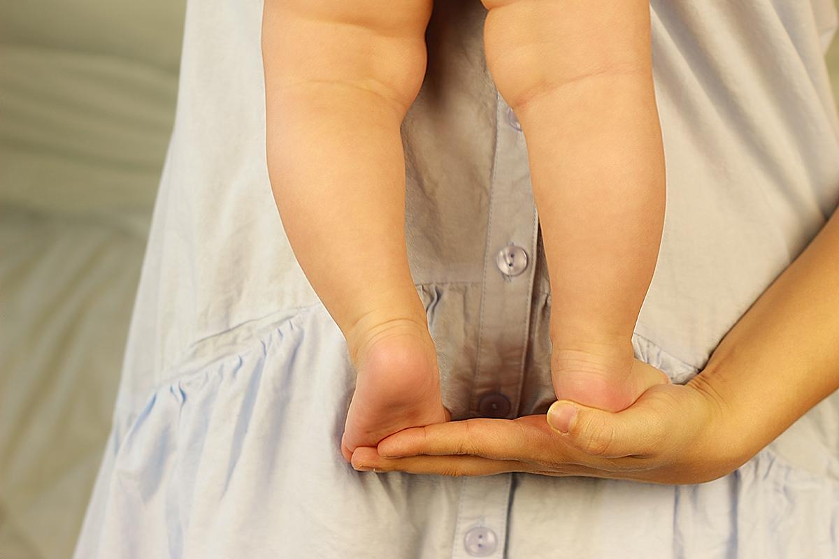 小孩長短腳如何矯正？症狀、治療、手術、術後照顧