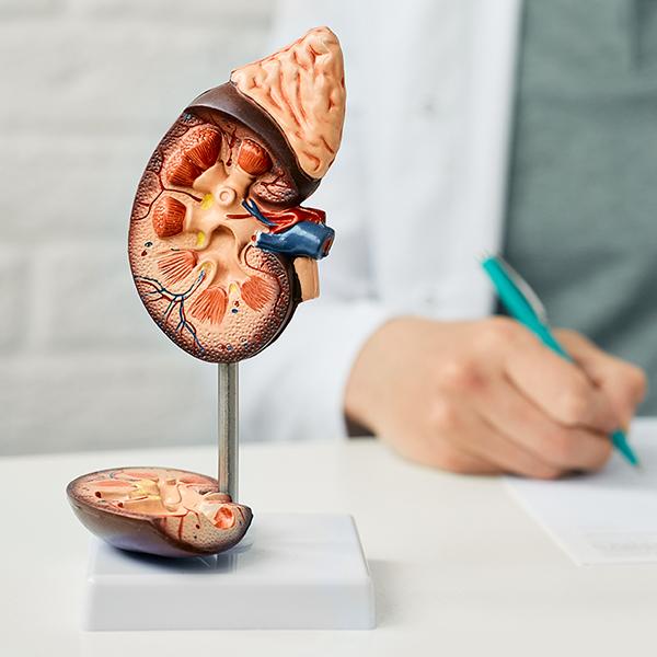 腎石傳說誰打破?交給軟式內視鏡碎石手術