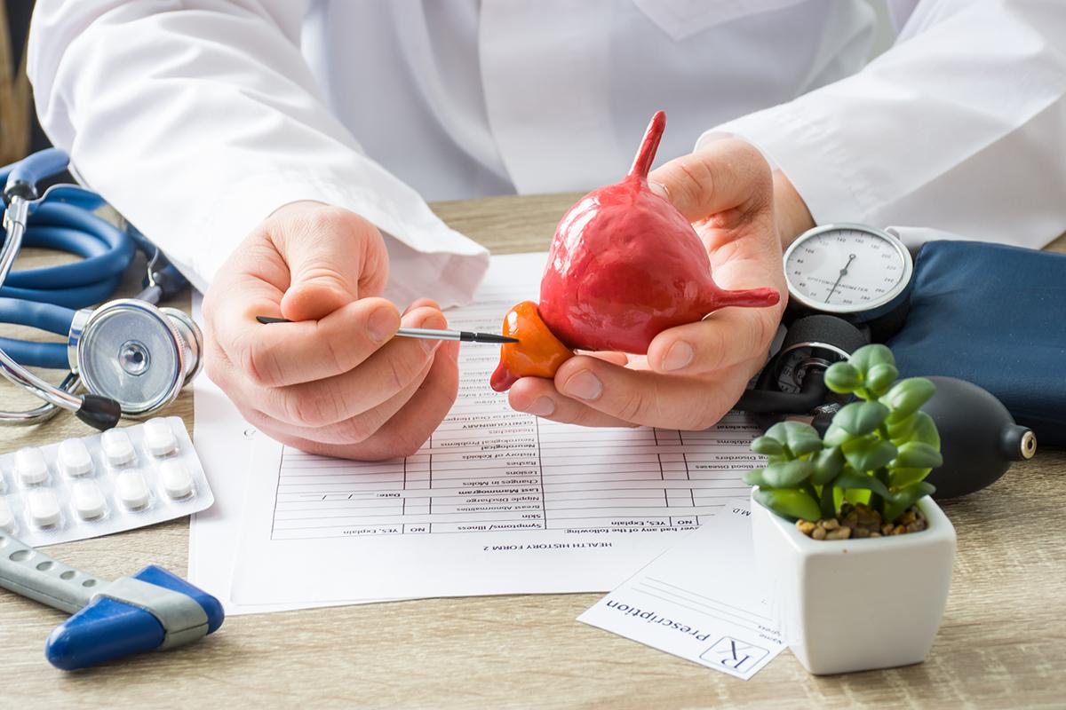 攝護腺癌存活率高嗎？前兆、症狀、檢查、治療方式
