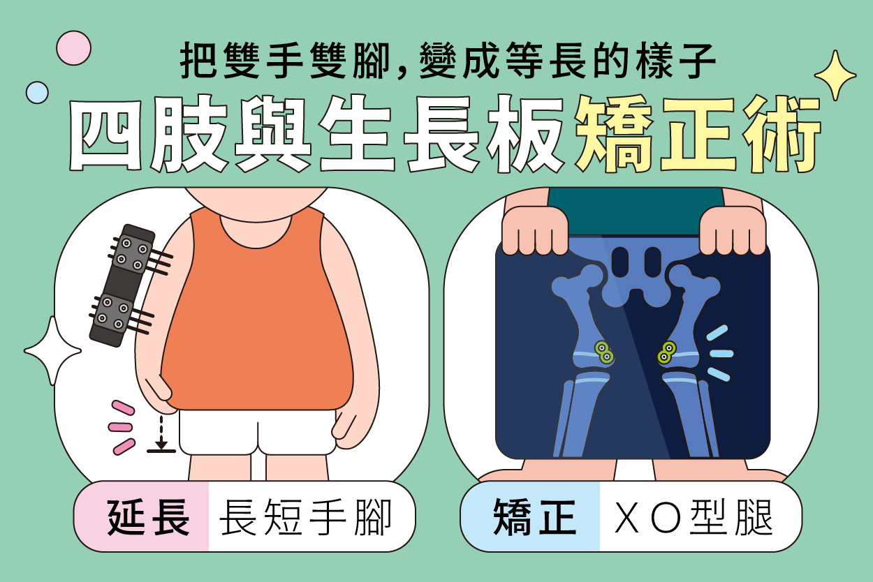 四肢矯正及兒童生長板(上)