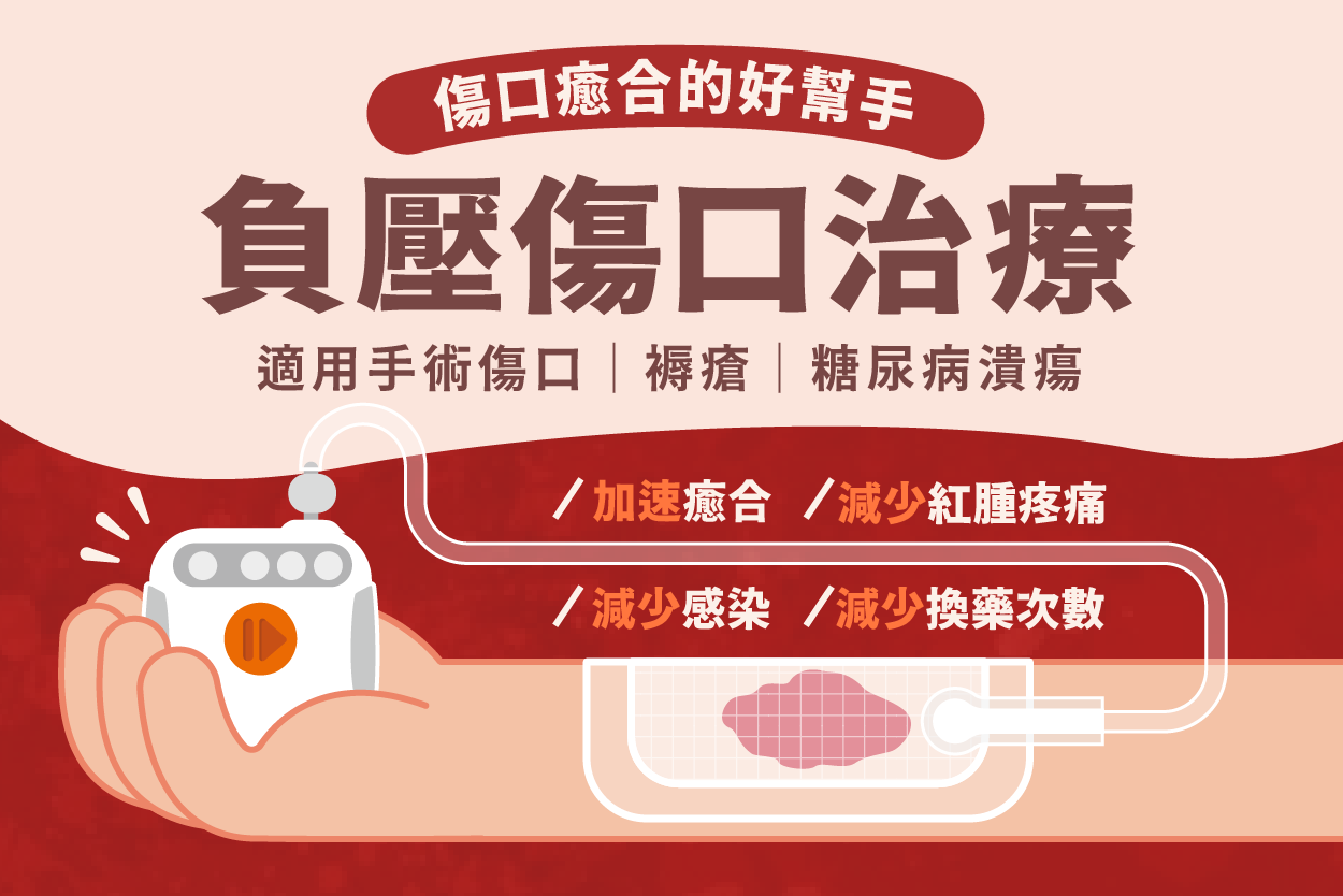 負壓傷口治療專題(上)