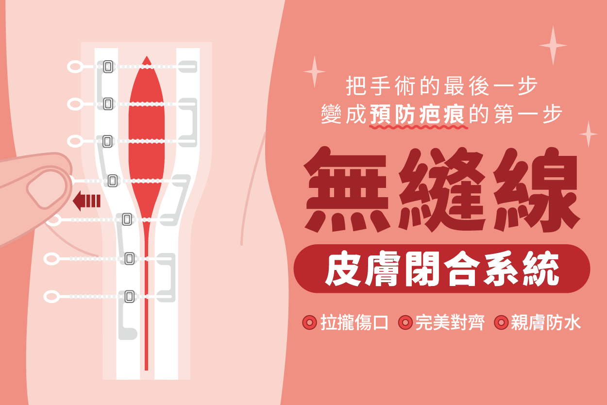 無縫線皮膚閉合系統(上)