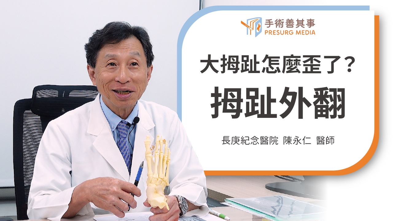 【拇趾外翻會怎樣？原因、矯正治療、開刀方式】陳永仁醫師／長庚紀念醫院