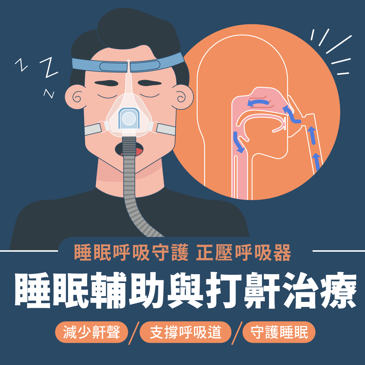 打呼就是睡眠呼吸中止症嗎？檢測方法、治療方案與正壓呼吸器的幫助