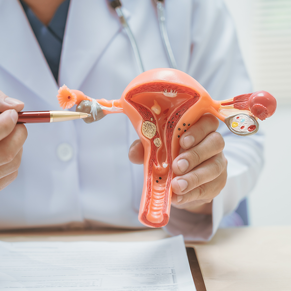 巧克力囊腫會消失嗎？原因、症狀、治療及手術方法 