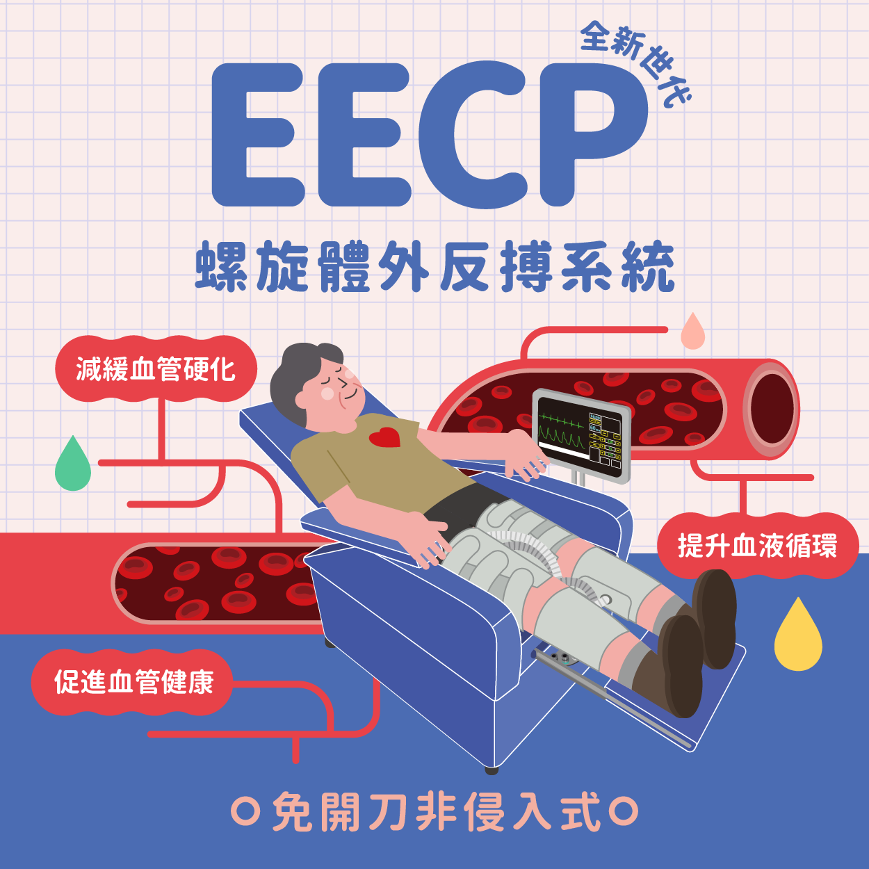 螺旋體外反搏系統EECP專題