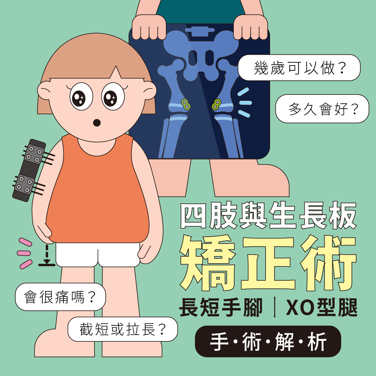 生長板受損如何發現？兒童O型腿、X型腿、長短腳的原因、矯正與手術方式