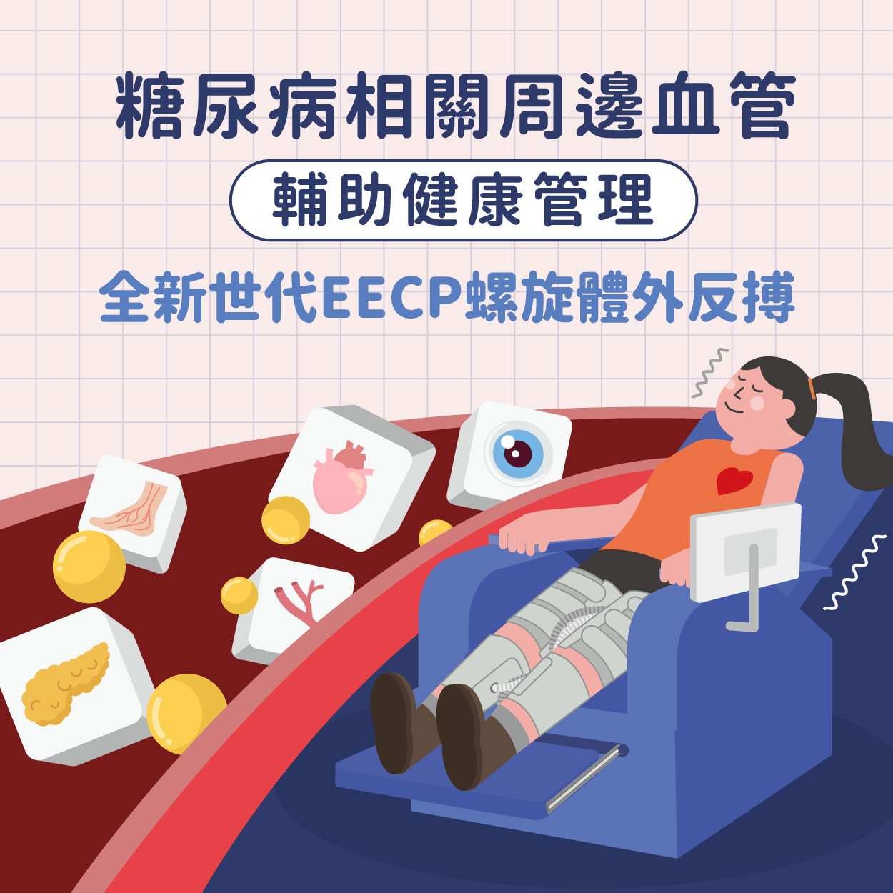 糖尿病會好嗎？全新世代EECP螺旋體外反搏促進血管健康