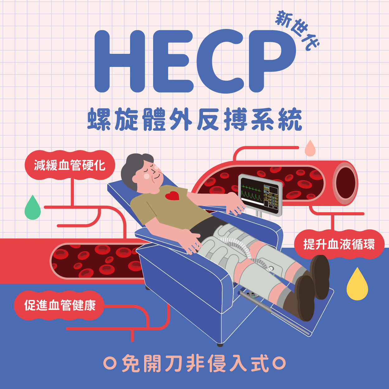 螺旋體外反搏系統HECP專題