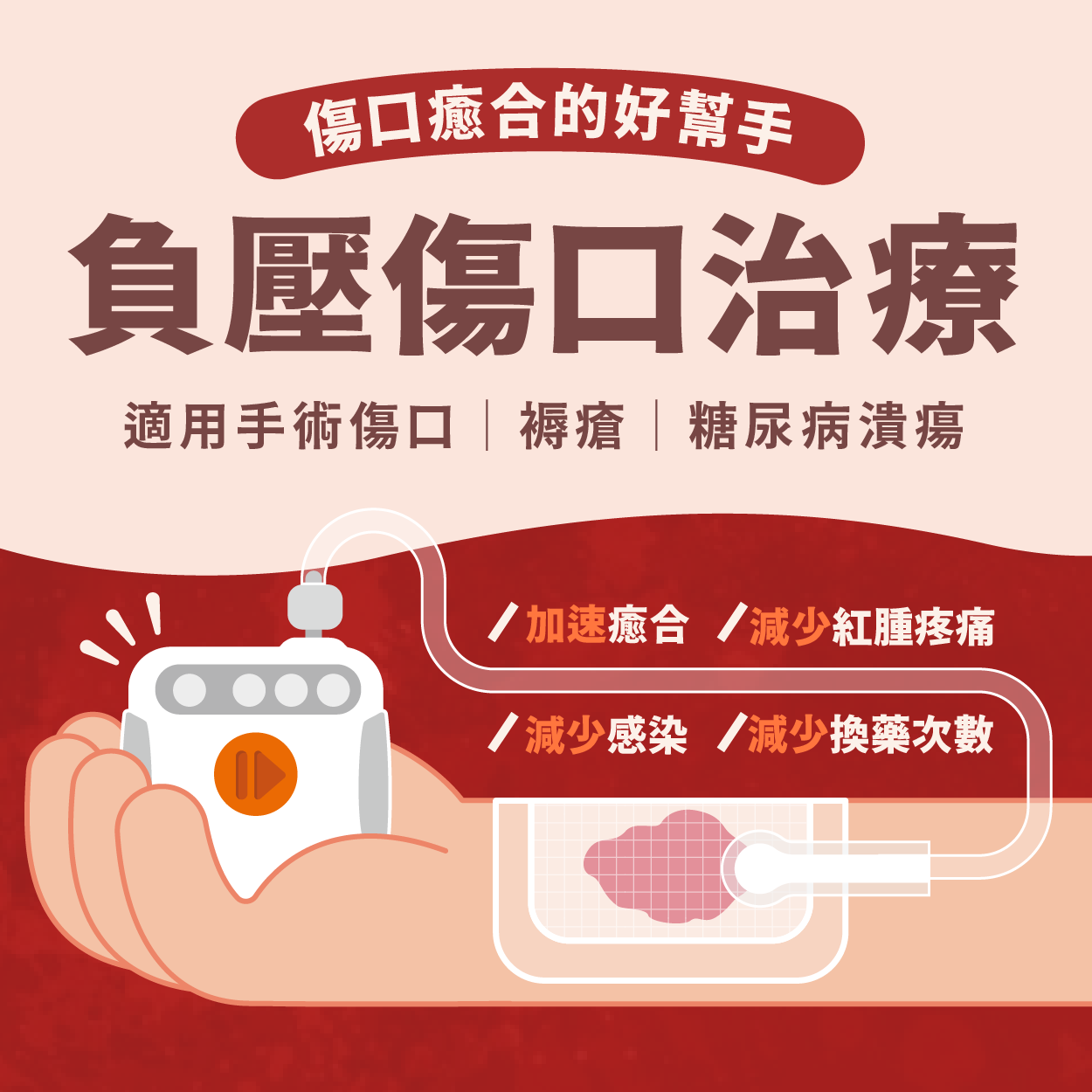 負壓傷口治療專題