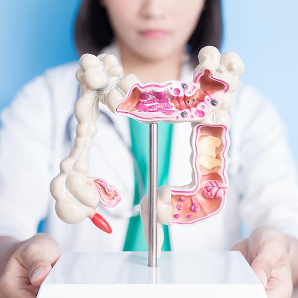 大腸癌由大腸息肉演變？症狀、成因、治療方式