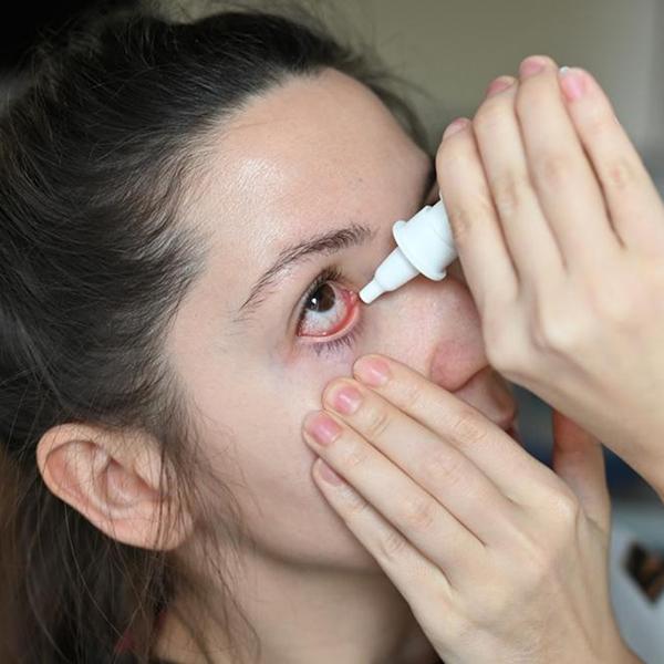 乾眼症點人工淚液還不夠？症狀、原因、檢查、治療一次看