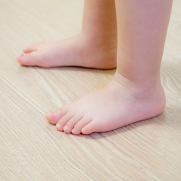 兒童扁平足如何矯正？原因、判斷方法、治療及手術方式