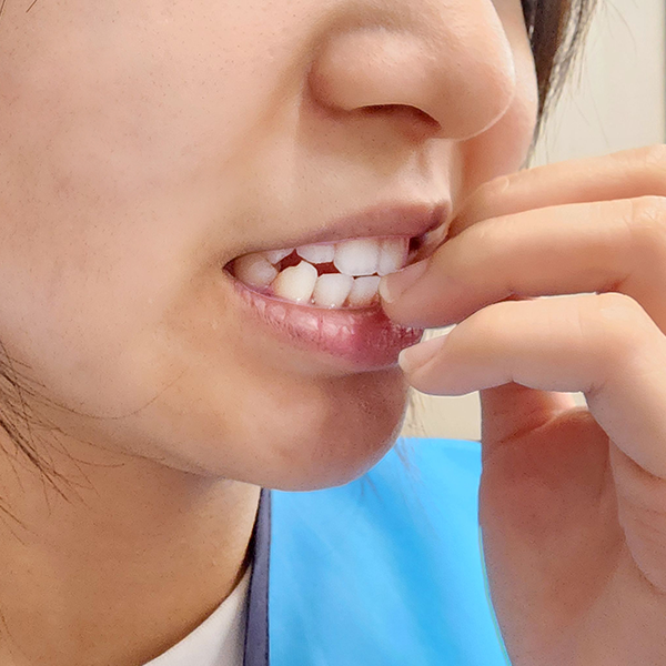 年輕女性剪指甲太深惹禍，急性甲溝炎痛到走不動