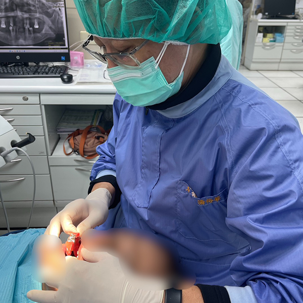 張口2公分也能重建笑容！中山附醫導入張口受限口腔癌患者之「數位口掃」技術